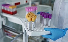 Лабораторию Бонецкого оштрафовали на 423 млн сомов из-за высоких цен во время пандемии COVID-19