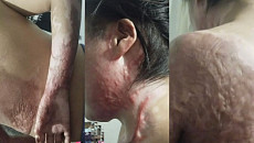 Муж облил жену бензином и поджег ее: Институт Омбудсмена рассказал подробности трагедии