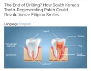 В Южной Корее изобрели пластырь для регенерации поврежденных зубов